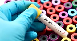 WHO: Milijun ljudi dnevno zarazi se spolno prenosivim bolestima